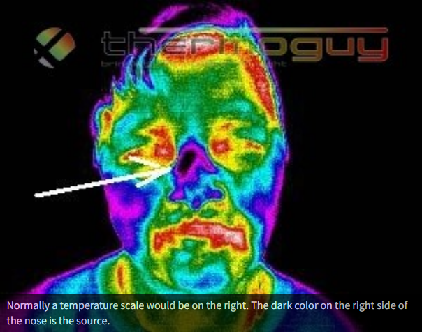 Normally a temperature scale would be on the right. The dark colour on the right side of the nose is the source.