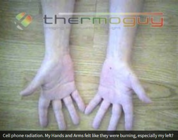 Cell phone radiation. My Hands and Arms felt like they were burning, especially my left?